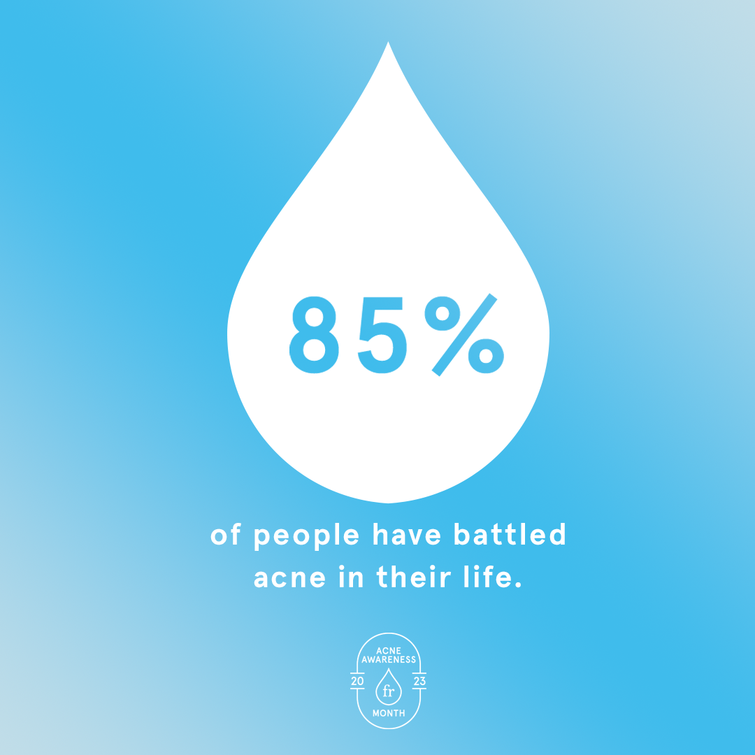 Acne Awareness Month (Stat 3)