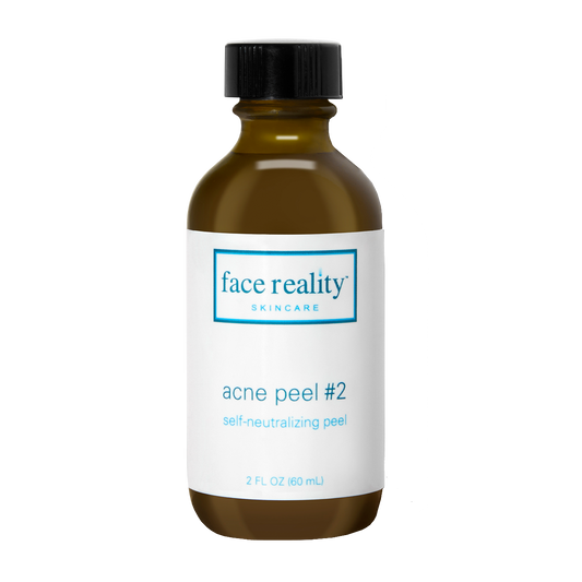 Acne Peel #2