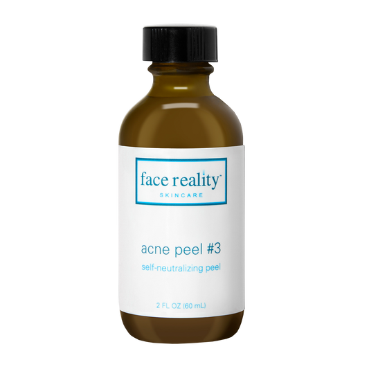 Acne Peel #3