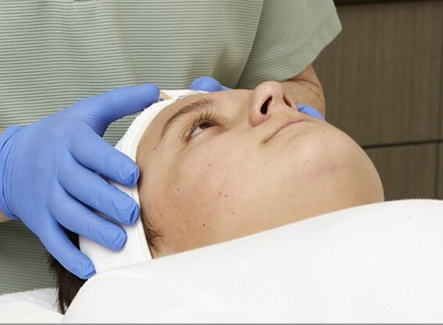 Treating Teen Acne Clients