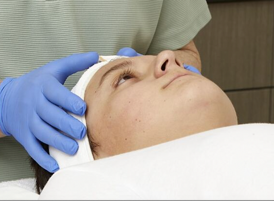 Treating Teen Acne Clients