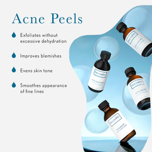 Acne Peel Benefits