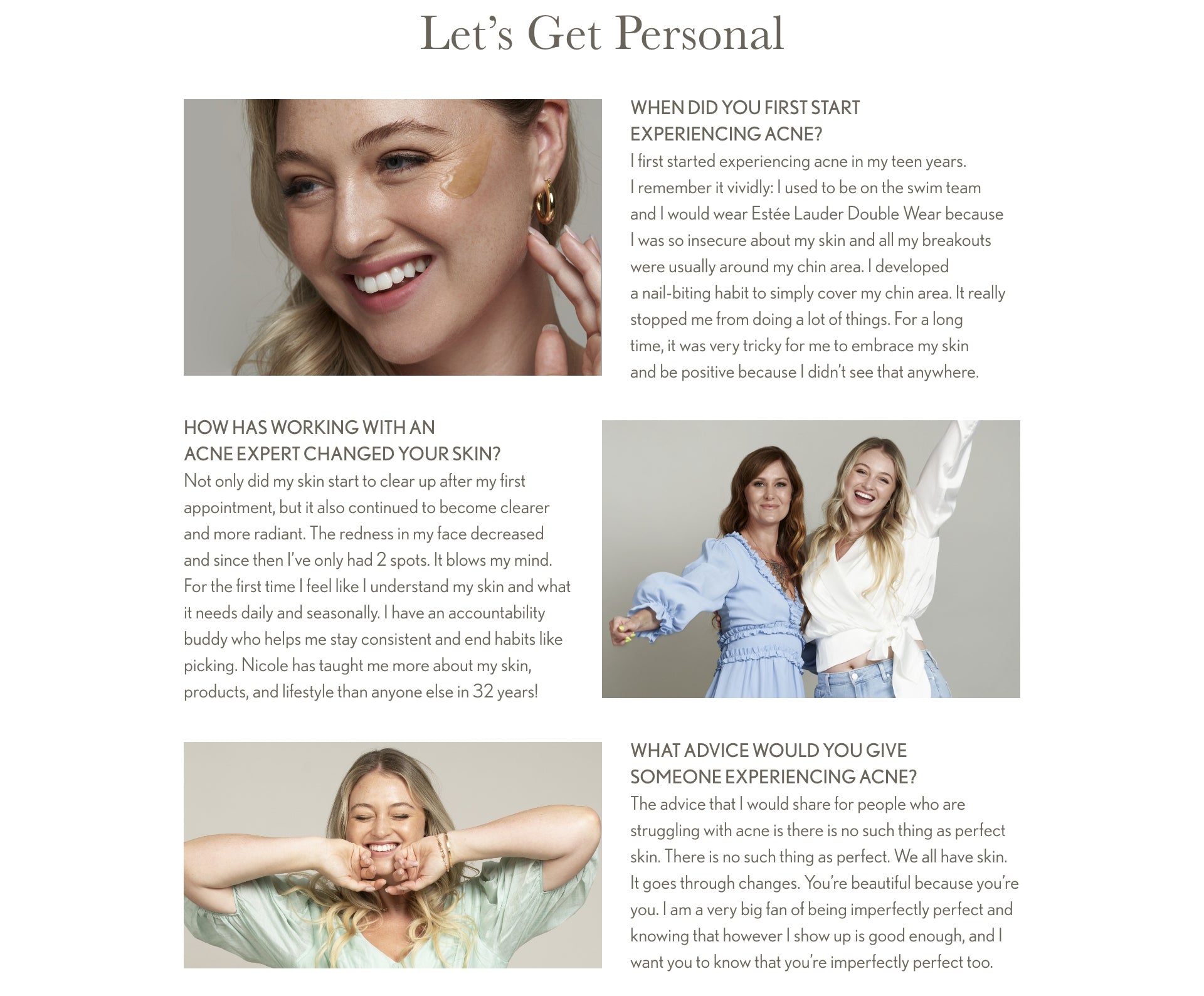 A section titled Let's Get Personal with information about Iskra's acne journey, including her teenage adolescent acne, how her skin cleared with Face Reality, and how she has only had 2 spots since getting clear. 3 photos of Iskra, 1 with her Acne Expert